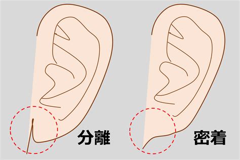 耳形|耳